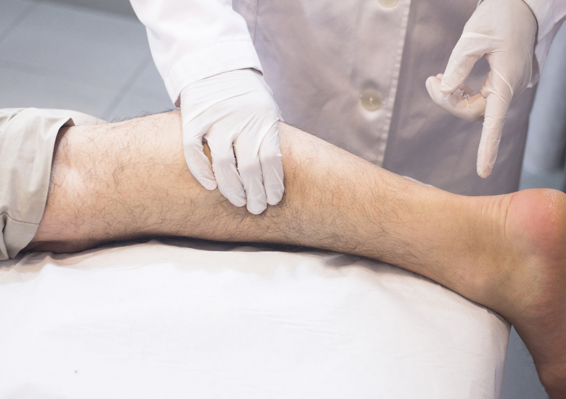 Ayurvedic Treatment